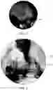 Fig. 03 - Vaso-occlusive device and delivery assembly
