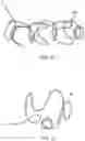 Fig. 04 - Vaso-occlusive device and delivery assembly