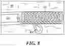 Fig. 10 - DEVICES, SYSTEMS, AND METHODS FOR MINIMALLY INVASIVE MODULATION OF ABDOMINAL TISSUE