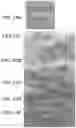 Fig. 15 - DEVICES, SYSTEMS, AND METHODS FOR MINIMALLY INVASIVE MODULATION OF ABDOMINAL TISSUE