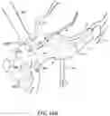 Fig. 17 - DEVICES, SYSTEMS, AND METHODS FOR MINIMALLY INVASIVE MODULATION OF ABDOMINAL TISSUE