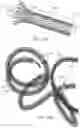 Fig. 14 - VASO-OCCLUSIVE DEVICES INCLUDING A FRICTION ELEMENT