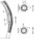 Fig. 22 - VASO-OCCLUSIVE DEVICES INCLUDING A FRICTION ELEMENT