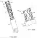 Fig. 29 - VASO-OCCLUSIVE DEVICES INCLUDING A FRICTION ELEMENT