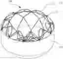 Fig. 01 - OCCLUDER SUPPORT AND PREPARATION METHOD THEREFOR