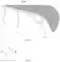 Fig. 03 - OCCLUDER SUPPORT AND PREPARATION METHOD THEREFOR