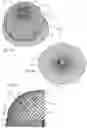 Fig. 08 - Occluding anatomical structures