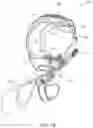 Fig. 11 - Holster and tourniquet device and method of use