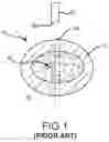 Fig. 02 - Surgical saw with sensing technology for determining cut through of bone and depth of the saw blade during surgery