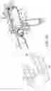 Fig. 18 - Surgical saw with sensing technology for determining cut through of bone and depth of the saw blade during surgery