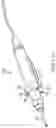 Fig. 19 - Surgical saw with sensing technology for determining cut through of bone and depth of the saw blade during surgery
