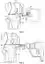 Fig. 08 - Tibial cutting guide assemblies and associated instrumentation for performing surgical methods