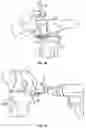 Fig. 10 - Tibial cutting guide assemblies and associated instrumentation for performing surgical methods