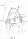 Fig. 09 - Tibial guide transfer instruments and methods