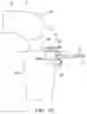 Fig. 16 - Tibial guide transfer instruments and methods