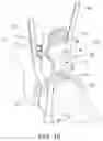 Fig. 19 - Tibial guide transfer instruments and methods