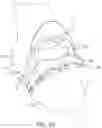 Fig. 28 - Tibial guide transfer instruments and methods