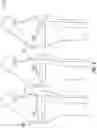 Fig. 12 - Tensor device for revision knee arthroplasty