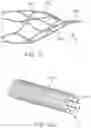 Fig. 26 - METHODS AND APPARATUS FOR RESTORING FLOW