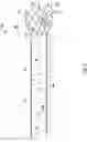 Fig. 03 - CATHETER INCLUDING A RADIOPAQUE EXPANDABLE MEMBER