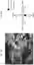 Fig. 15 - System and method for detecting and aligning acoustic beam in situ to a target using wide-beam, low frequency (<1 mhz) ultrasound