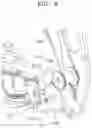 Fig. 14 - End tool for surgical instrument and method of manufacturing the same