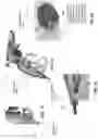 Fig. 71 - MEDICAL INSTRUMENTS FOR PERFORMING MINIMALLY-INVASIVE PROCEDURES