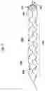 Fig. 02 - STENT RETRIEVER WITH EMBOLIC PREVENTION DEVICE