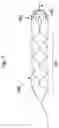 Fig. 04 - STENT RETRIEVER WITH EMBOLIC PREVENTION DEVICE