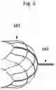 Fig. 07 - STENT RETRIEVER WITH EMBOLIC PREVENTION DEVICE