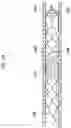 Fig. 11 - STENT RETRIEVER WITH EMBOLIC PREVENTION DEVICE