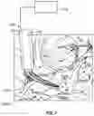 Fig. 08 - SURGICAL INSTRUMENT WITH FLEXIBLE END EFFECTOR
