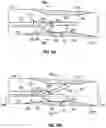 Fig. 11 - SURGICAL INSTRUMENT WITH FLEXIBLE END EFFECTOR