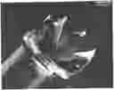 Fig. 01 - APPARATUSES, SYSTEMS AND METHODS FOR PERFORATING AND ASPIRATING INNER EAR