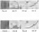 Fig. 15 - APPARATUSES, SYSTEMS AND METHODS FOR PERFORATING AND ASPIRATING INNER EAR