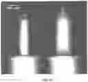 Fig. 19 - APPARATUSES, SYSTEMS AND METHODS FOR PERFORATING AND ASPIRATING INNER EAR