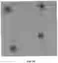 Fig. 26 - APPARATUSES, SYSTEMS AND METHODS FOR PERFORATING AND ASPIRATING INNER EAR