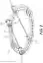 Fig. 03 - Fixators for bone stabilization and associated systems and methods