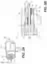 Fig. 04 - Fixators for bone stabilization and associated systems and methods