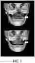 Fig. 04 - HEAD MOUNTED ROBOTIC SYSTEM AND METHOD