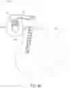 Fig. 11 - Low-profile offset-type spinal fusion device