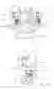 Fig. 14 - APPARATUS FOR BONE STABILIZATION AND DISTRACTION AND METHODS OF USE