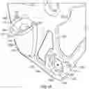 Fig. 09 - Suprapectineal quadrilateral bone plating system and methods of making and using same
