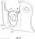 Fig. 10 - Suprapectineal quadrilateral bone plating system and methods of making and using same