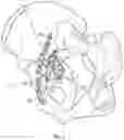 Fig. 11 - Suprapectineal quadrilateral bone plating system and methods of making and using same