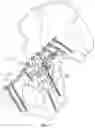 Fig. 12 - Suprapectineal quadrilateral bone plating system and methods of making and using same