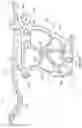 Fig. 13 - Suprapectineal quadrilateral bone plating system and methods of making and using same