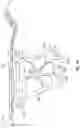Fig. 16 - Suprapectineal quadrilateral bone plating system and methods of making and using same