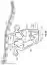 Fig. 22 - Suprapectineal quadrilateral bone plating system and methods of making and using same
