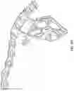 Fig. 24 - Suprapectineal quadrilateral bone plating system and methods of making and using same